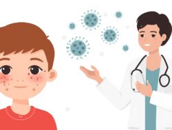 Kasus Campak Ditemukan di Beberapa Wilayah, Masyarakat Diminta Kenali Gejala dan Cara Penanganannya